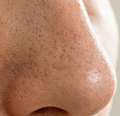 Zbliżenie na pory skóry